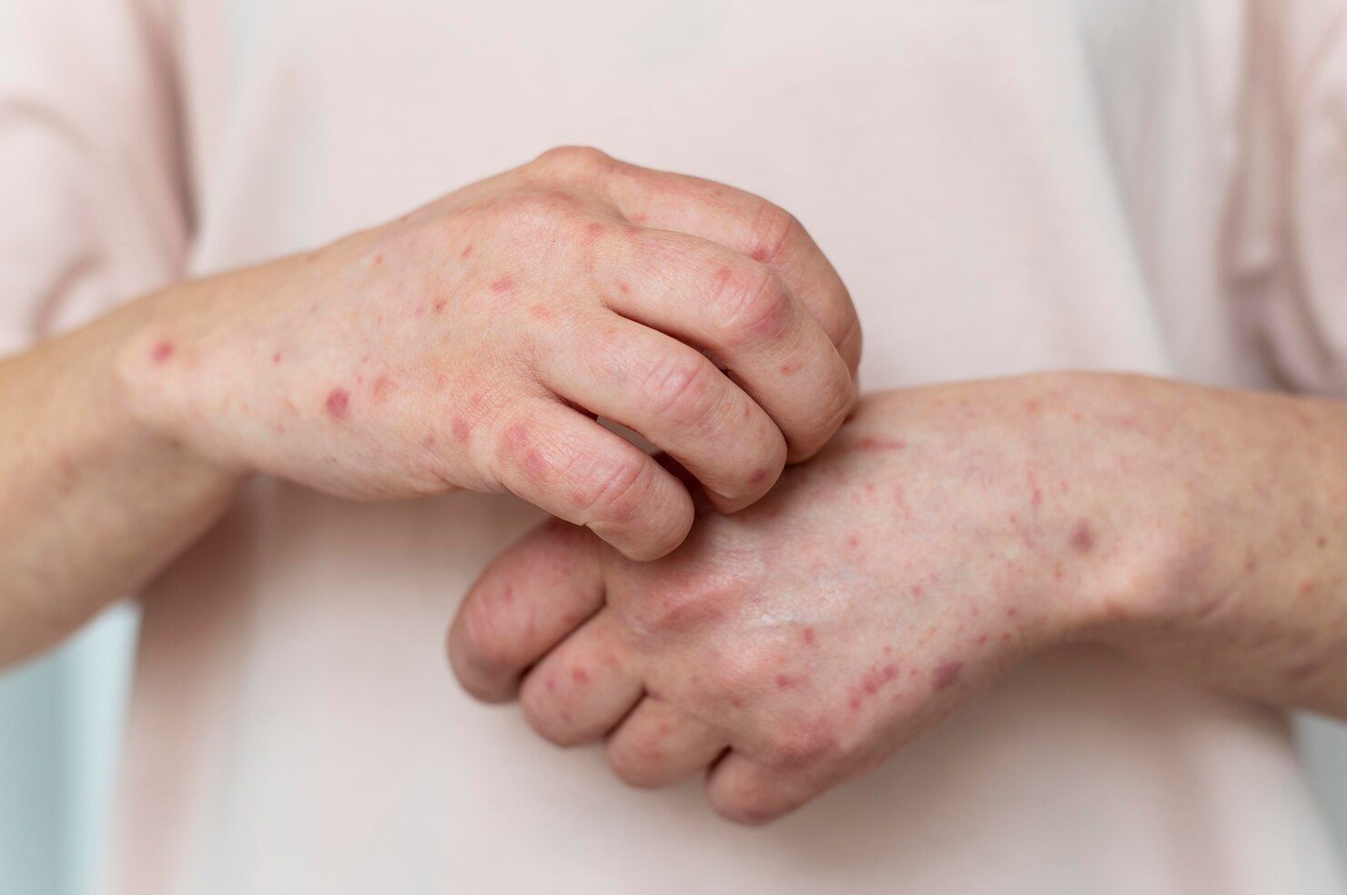 skin-allergy-person-s-arm_23-2149140509