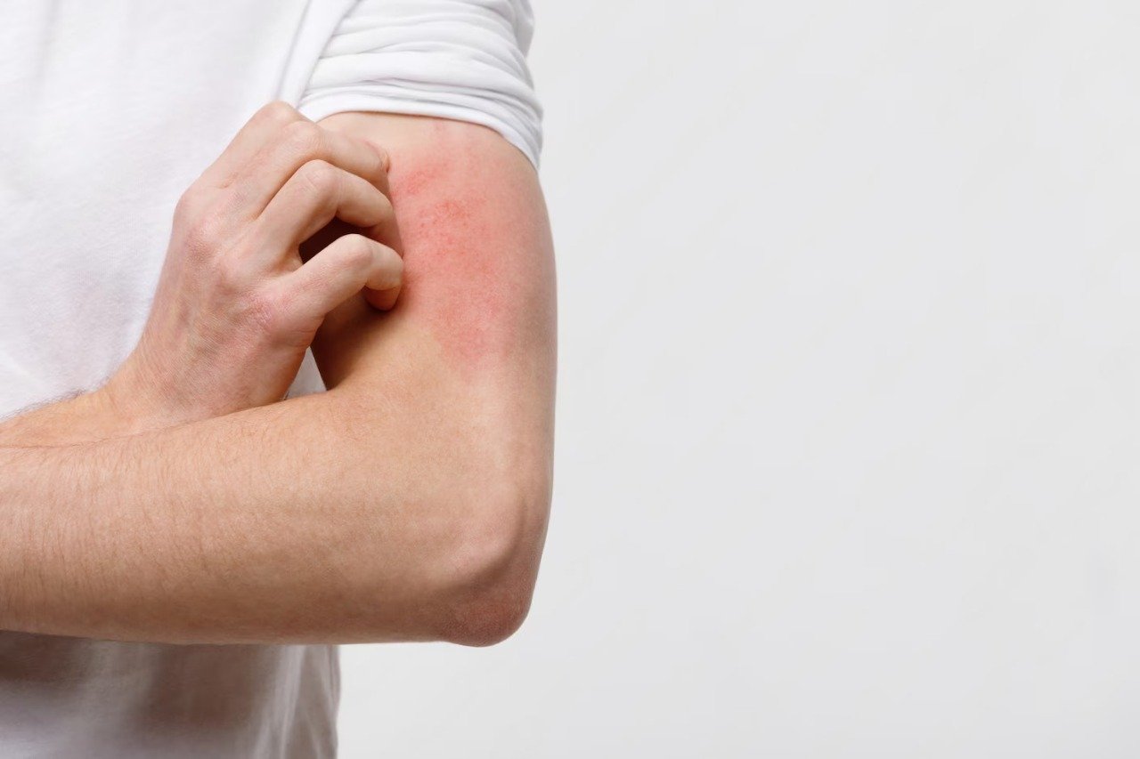 close-up-male-scratching-itch-his-hand-isolated-grey-background_165285-3