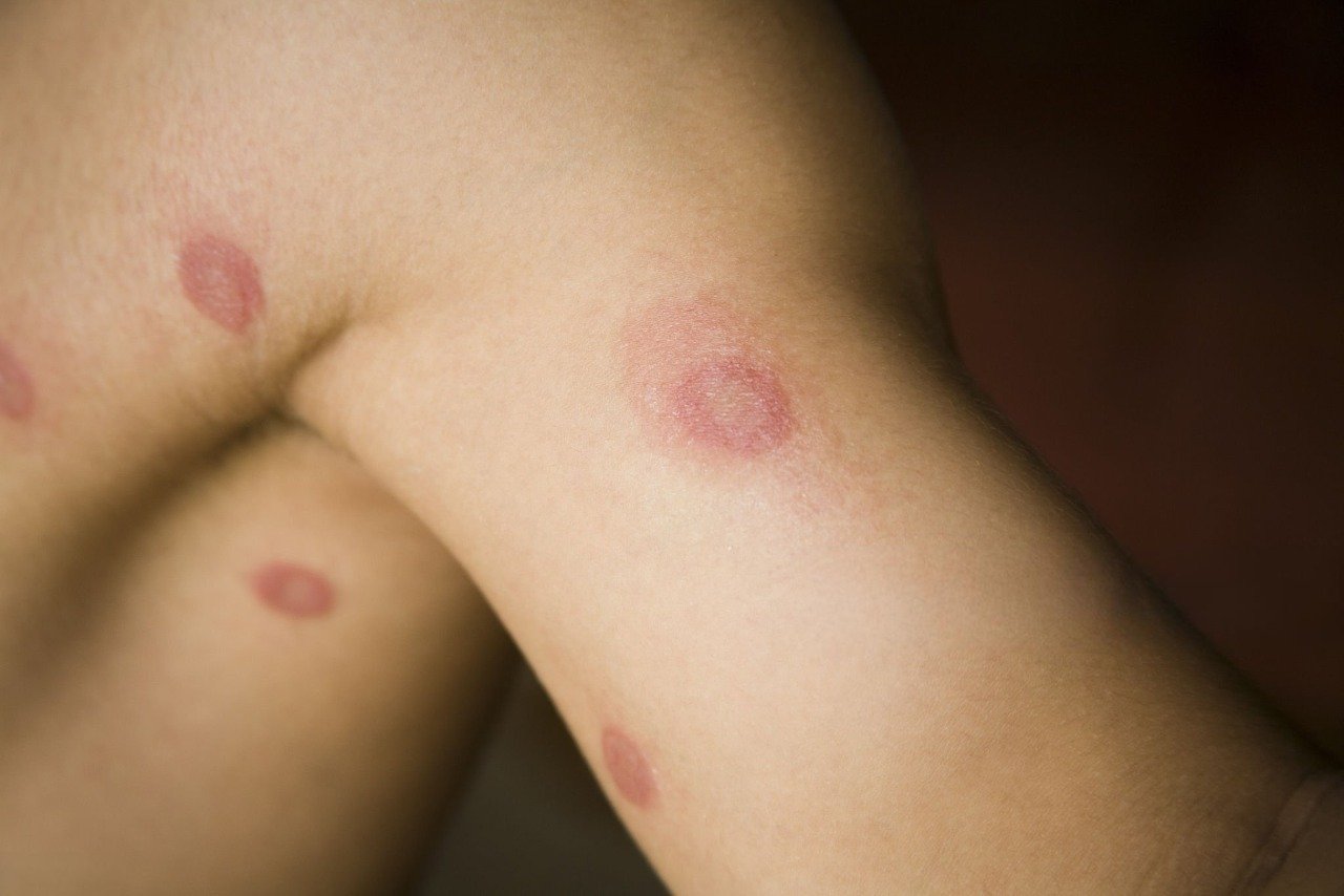 istockphoto-176099272-2048×2048